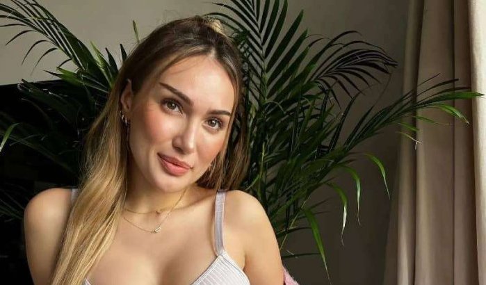 Luna Skye vertelt over mislukte plastische chirurgie in Marokko