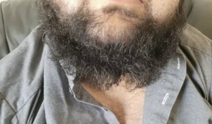 Moslim neergestoken in Canada, baard weggesneden