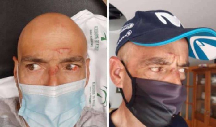 Marokkaanse Nederlander opgepakt voor zware mishandeling op Spaanse Costa del Sol