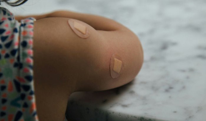 Mazelenvariant uit Marokko alarmerend veel in Brussel