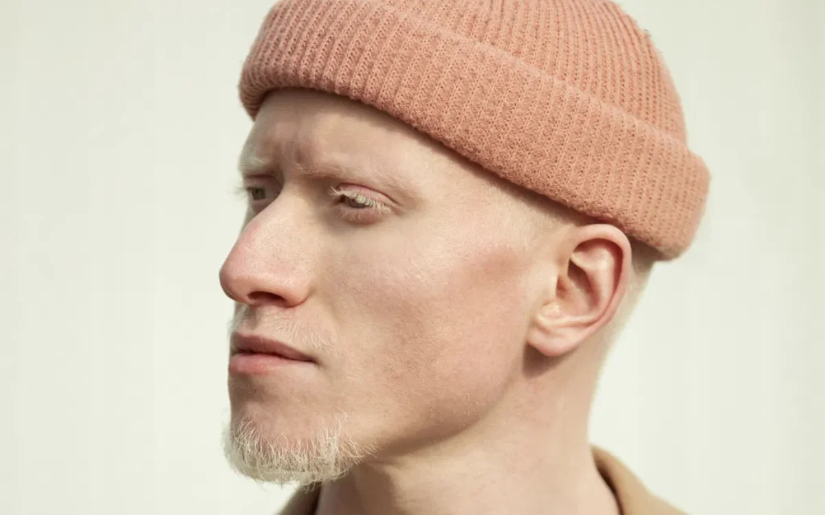 Nederlands-Marokkaanse Khalid Amakran deelt eerlijk zelfportret