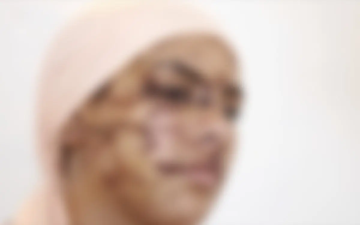 Marokkaanse vrouw zwaar toegetakeld door ex-man: 130 hechtingen nodig