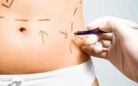 Dodelijke liposuctie in Casablanca