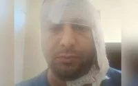 Raadslid aangevallen met mes in Larache