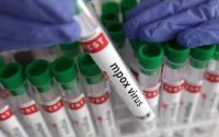 Marokkaanse mpox-test goedgekeurd door Afrika