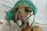 Bejaarde vrouw in coma na verkrachtingspoging in Marokko