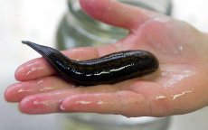 Meisje in Marokko leefde met bloedzuiger van 6 cm in keel