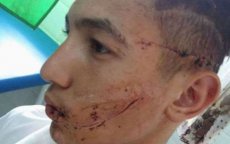 Voetballer met scheermes aangevallen in Tetouan (foto's)