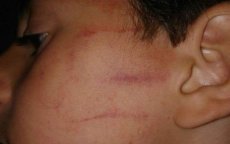 Kind op eerste schooldag door lerares mishandeld in Marokko (foto)