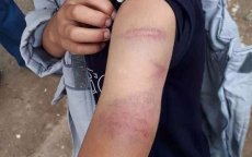 Lerares mishandelt leerling die 'M' niet kan schrijven in Chefchaouen