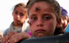 Leishmaniase epidemie in Zagora, 150 kinderen getroffen (video)