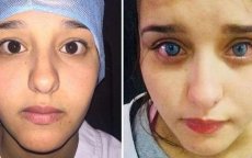 Primeur in Marokko: vrouw verandert definitief van oogkleur