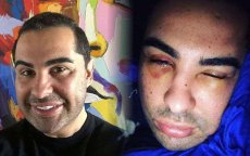 Bekende seksuoloog Doc Samad verlaat Marokko na mishandeling