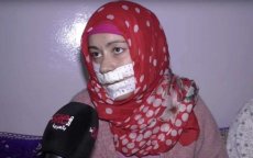 Bekende chirurgisch helpt vrouw die in Casablanca door dief werd verminkt (video)