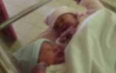 Marokko: vrouw is zwanger van tweeling maar krijgt slechts één baby mee