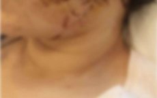 Mohamed Daly opgepakt voor verminken ex-vrouw in Molenbeek