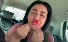 Marokkaanse vlogster Nada Hassi op straat aangevallen (video)