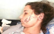 Marokkaanse ernstig toegetakeld door huurmoordenaar