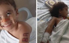 Marokkaans meisje (3) met zeldzame ziekte succesvol geopereerd in Spanje