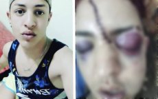 Spaanse Marokkaan slachtoffer homofobe aanval in Kenitra
