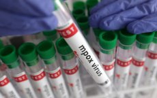 Marokkaanse mpox-test goedgekeurd door Afrika
