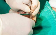 Arts in Nador moet 10 miljoen dirham betalen na foute besnijdenis