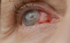 Rabat: patiënt blind na operatie door nepdokters