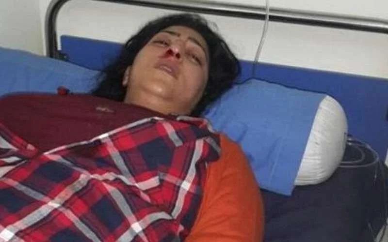 Dounia Boutazout gewond na aanval in Casablanca (foto's)
