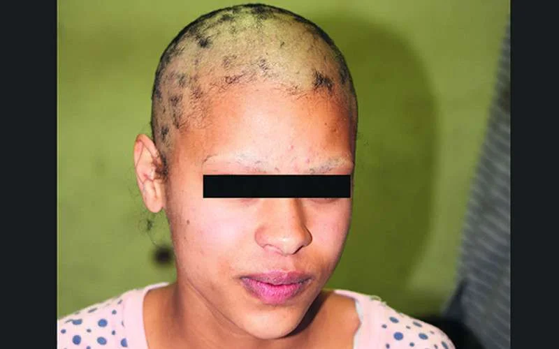 Celstraf voor studenten die meisje kaalschoren in Meknes