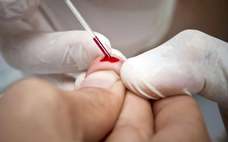 Aids-testen in gevangenissen Marokko