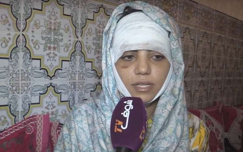 Man in Marokko snijdt oor vrouw af vanwege haar houding (video)