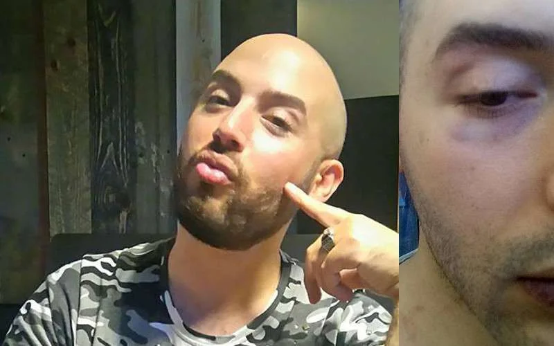 Mishandelde homo Adouma vertelt over aanval