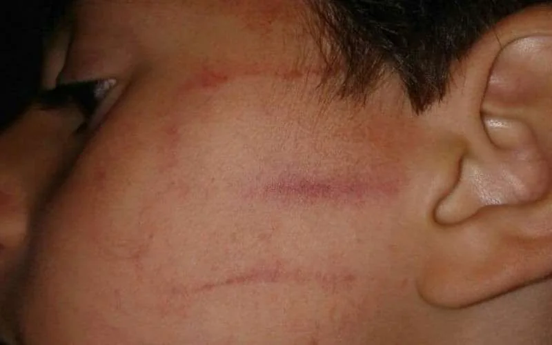 Kind op eerste schooldag door lerares mishandeld in Marokko (foto)