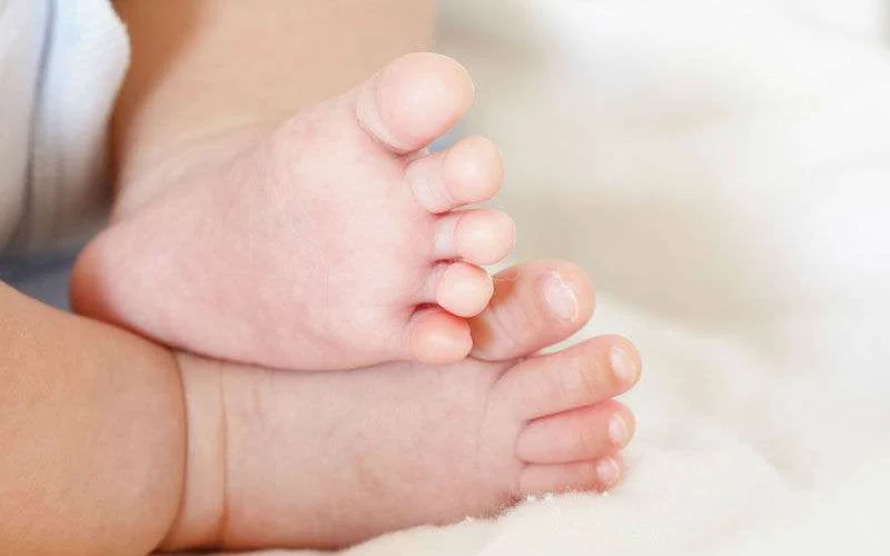 Baby met twee hoofdjes geboren in Rabat