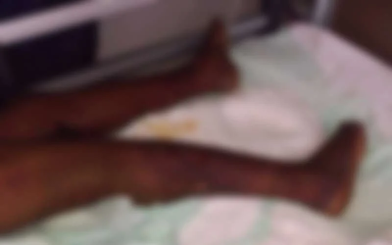 Meid bijna doodgemarteld door werkgevers in Casablanca