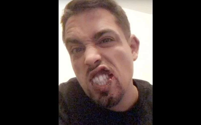 Bekende Marokkaanse rapper zwaar mishandeld in Frankrijk