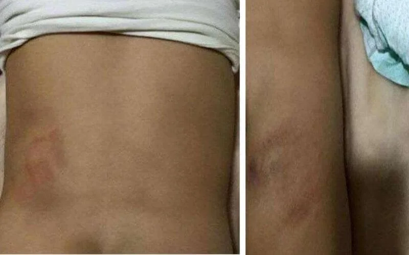 Spanje: Marokkaanse staat terecht voor straffen kinderen met elektrische kabel