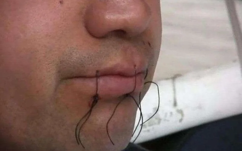 Marokkaan naait lippen dicht om uitzetting te voorkomen in Frankrijk