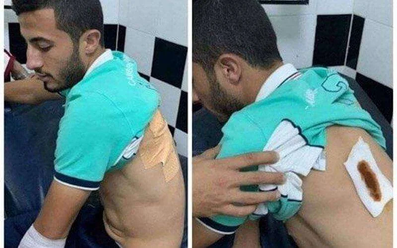 Marokko: speler Wydad door supporters neergestoken