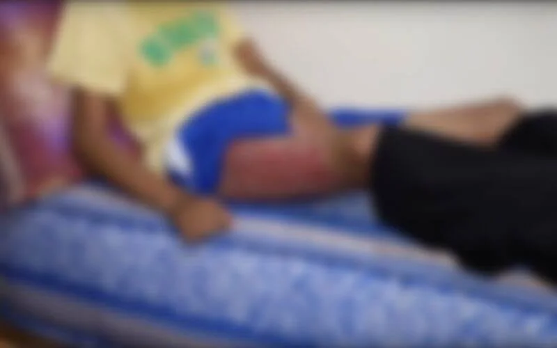 Tiener in brand gestoken in Marokko