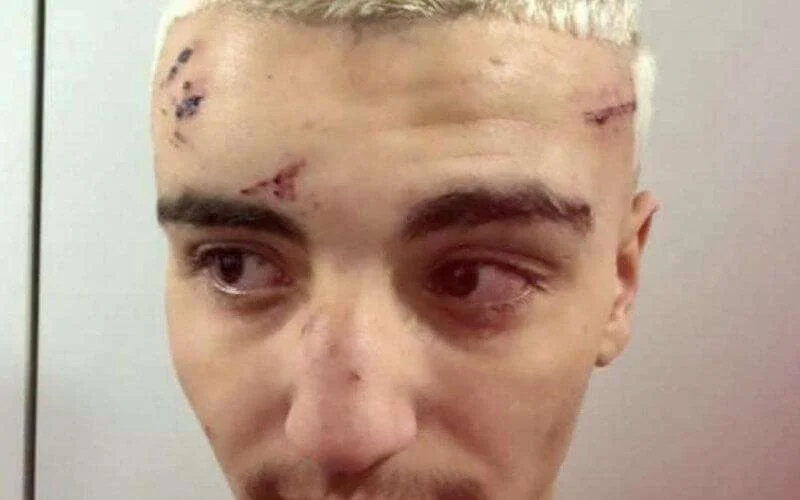 Zoon bekende crimineel door politie mishandeld in België