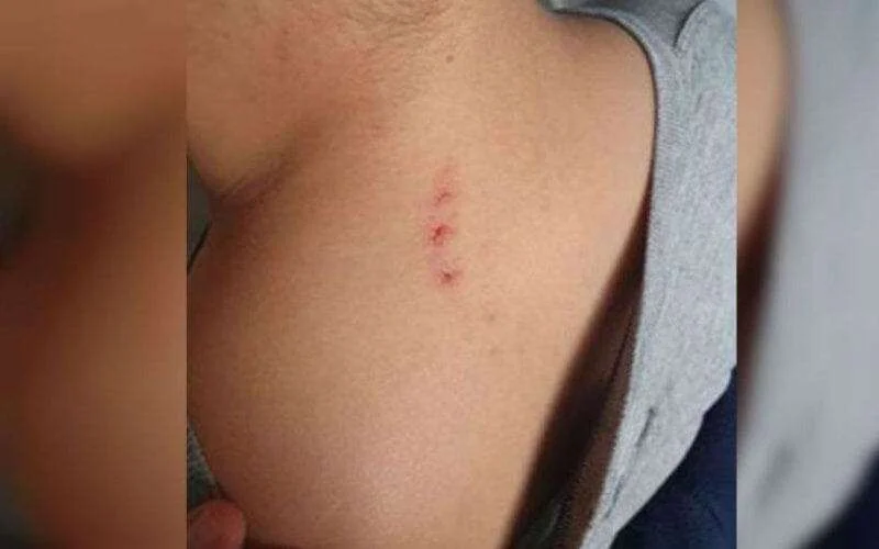 Bilal (8) door lerares mishandeld in Frankrijk