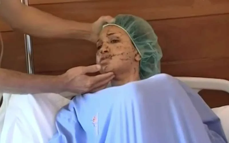 Verkrachter in Marokko bewerkt vrouw met scheermes zodat ze niet zou hertrouwen