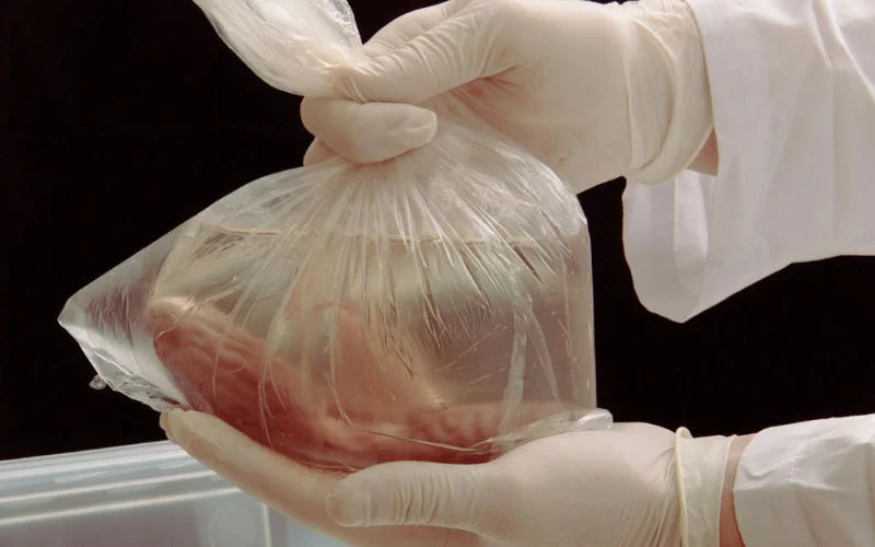 Marokkaanse justitie reageert op orgaanroof na verkeersongeval