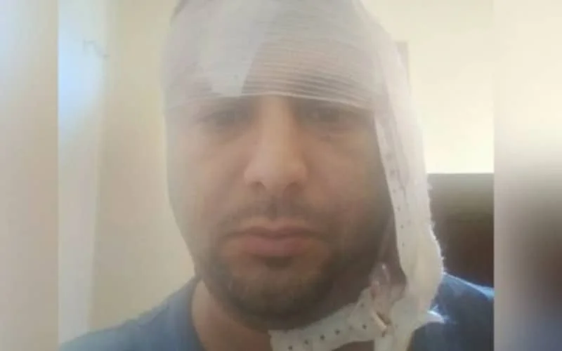 Raadslid aangevallen met mes in Larache