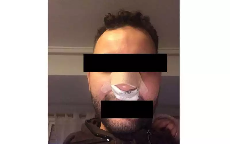 Racistische aanval in Spanje: Marokkaan eist gerechtigheid