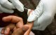Marokkaanse ministerie: opzettelijke besmetting HIV-virus is gerucht